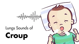 Sounds of Croup Laryngotracheitis  Lung Sounds  MEDZCOOL [upl. by Paymar]