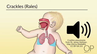 Respiratory Assessment by B Leary L DelSignore  OPENPediatrics [upl. by Tammy23]