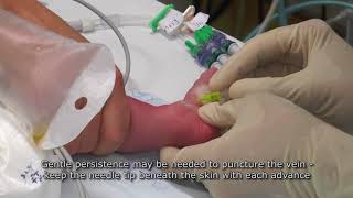 Paediatric Anaesthetics Chapter 7  Long saphenous IV neonate 1 [upl. by Nraa938]