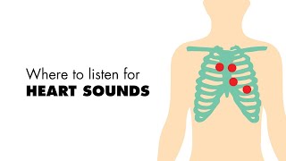 Where to listen for Heart Sounds Auscultory Areas  MEDZCOOL [upl. by Amada]