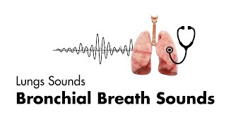 Bronchial Breath Sounds  Lung Sounds  Medzcool [upl. by Hampton501]