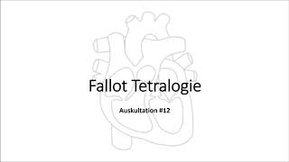 Auskultation 12 Fallot Tetralogie [upl. by Goldfarb156]